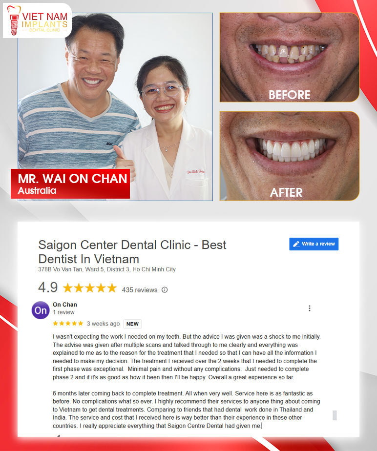 customer review 1 customer review 1