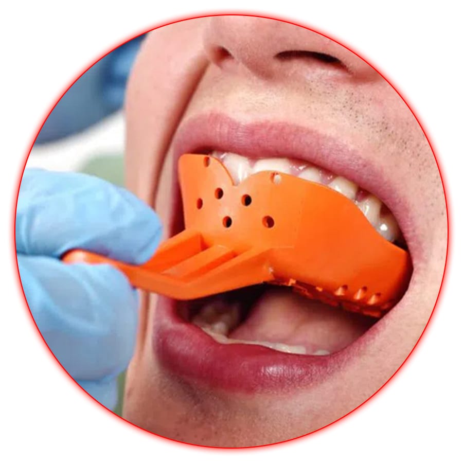 dental impressions dental impressions