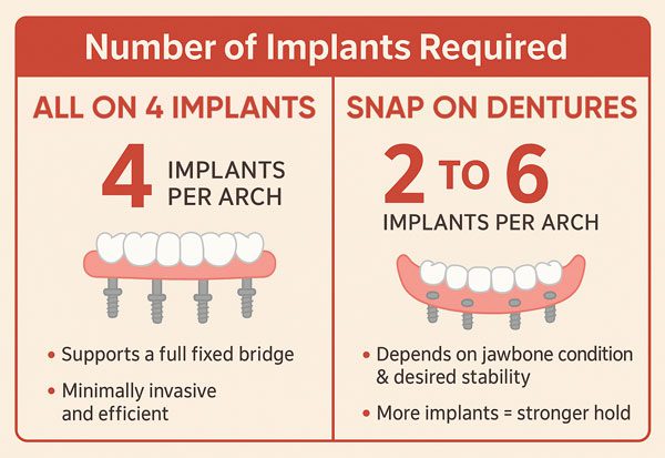 Number of Implants Required Number of Implants Required