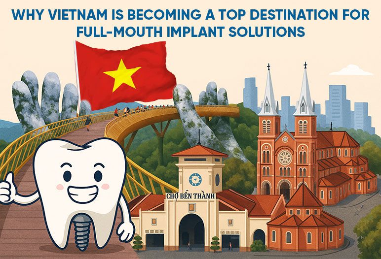 Why Vietnam is becoming a top destination for full mouth implant solutions Why Vietnam is becoming a top destination for full mouth implant solutions